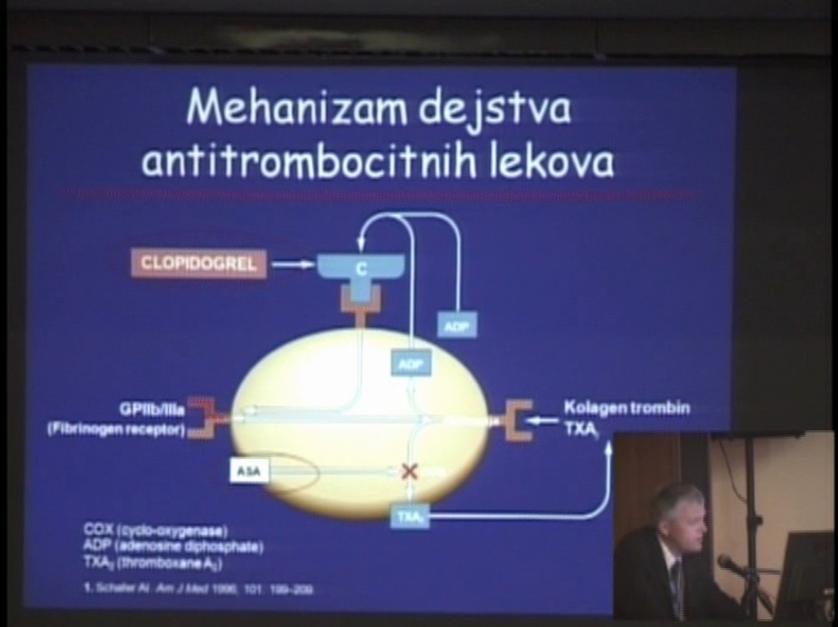 Šta treba znati o antiagregacionoj terapiji kod bolesnika sa PCI